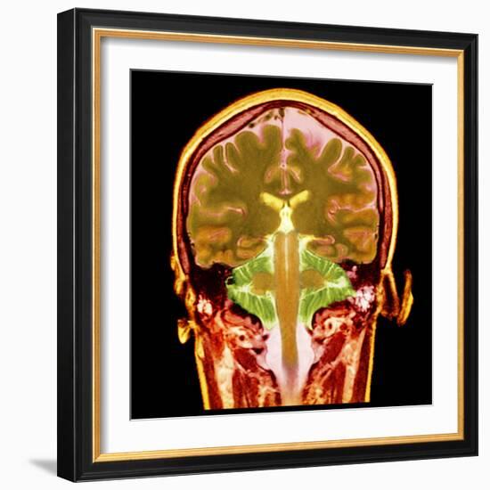 Healthy Brain, MRI Scan-Science Photo Library-Framed Premium Photographic Print