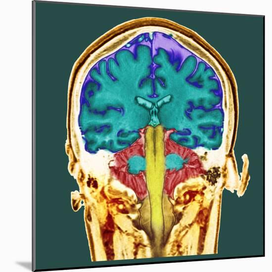 Healthy Brain, MRI Scan-Science Photo Library-Mounted Premium Photographic Print