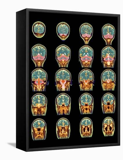 Healthy Brain, MRI Scans-Science Photo Library-Framed Premier Image Canvas