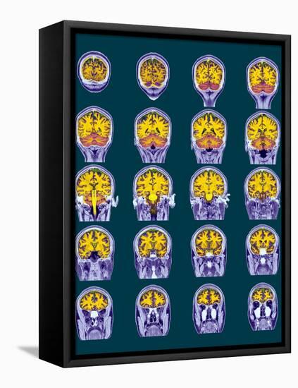 Healthy Brain, MRI Scans-Science Photo Library-Framed Premier Image Canvas