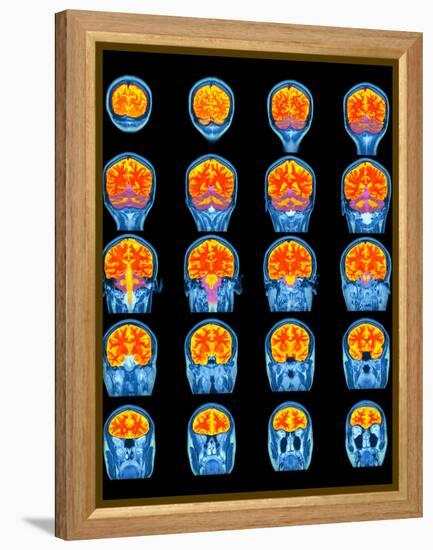 Healthy Brain, MRI Scans-Science Photo Library-Framed Premier Image Canvas