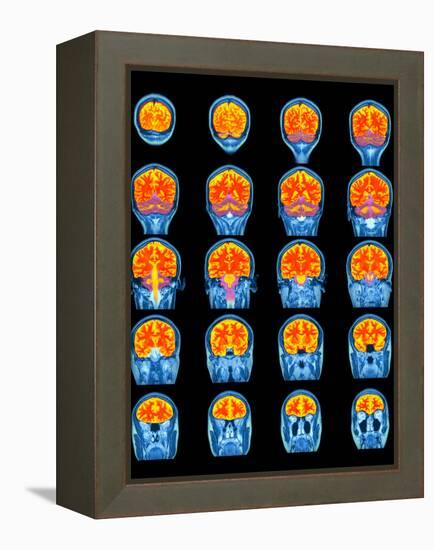 Healthy Brain, MRI Scans-Science Photo Library-Framed Premier Image Canvas