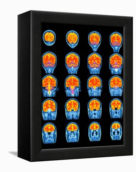 Healthy Brain, MRI Scans-Science Photo Library-Framed Premier Image Canvas