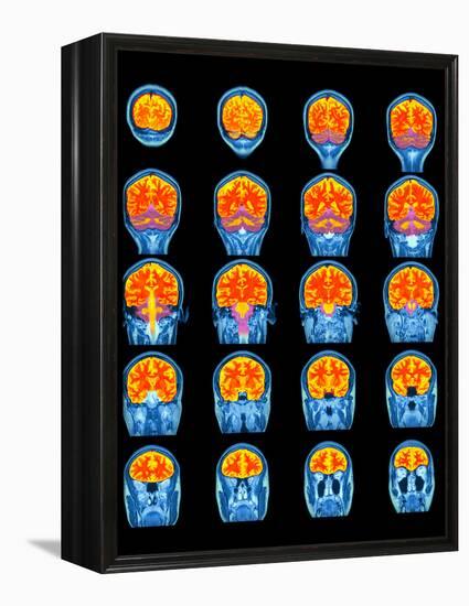 Healthy Brain, MRI Scans-Science Photo Library-Framed Premier Image Canvas
