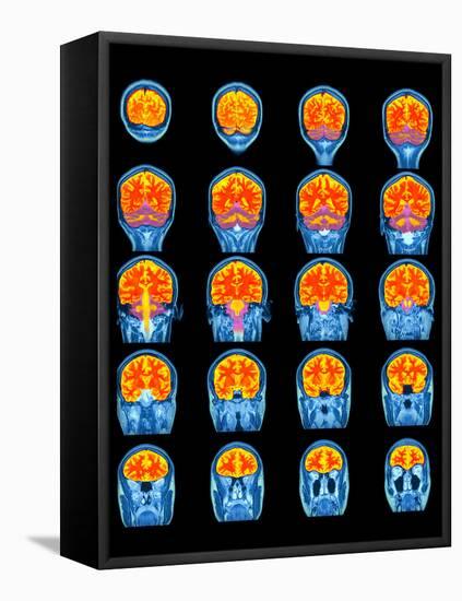 Healthy Brain, MRI Scans-Science Photo Library-Framed Premier Image Canvas