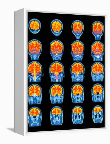 Healthy Brain, MRI Scans-Science Photo Library-Framed Premier Image Canvas