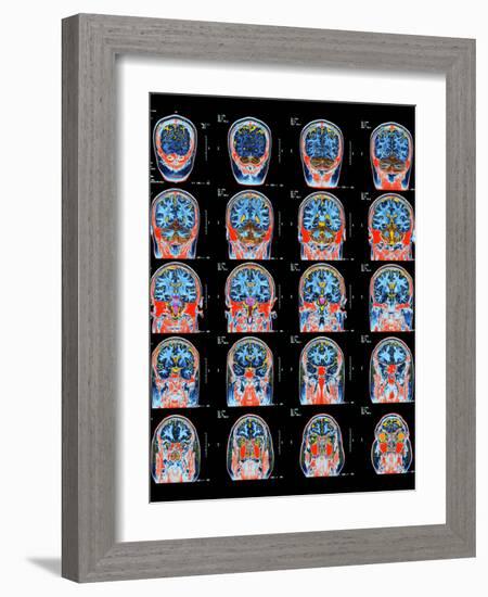 Healthy Brain, MRI Scans-Science Photo Library-Framed Photographic Print