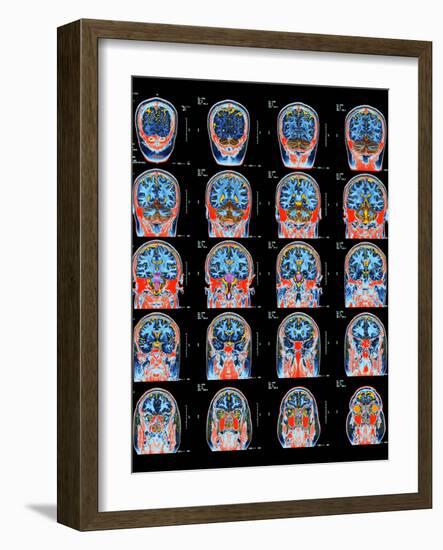 Healthy Brain, MRI Scans-Science Photo Library-Framed Photographic Print