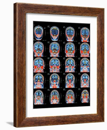 Healthy Brain, MRI Scans-Science Photo Library-Framed Photographic Print