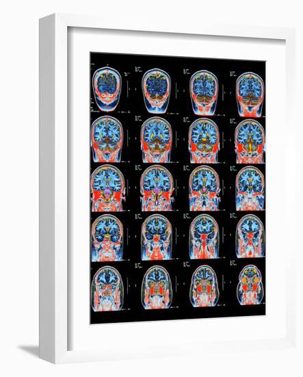 Healthy Brain, MRI Scans-Science Photo Library-Framed Photographic Print