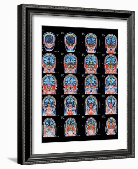 Healthy Brain, MRI Scans-Science Photo Library-Framed Photographic Print