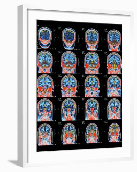 Healthy Brain, MRI Scans-Science Photo Library-Framed Photographic Print