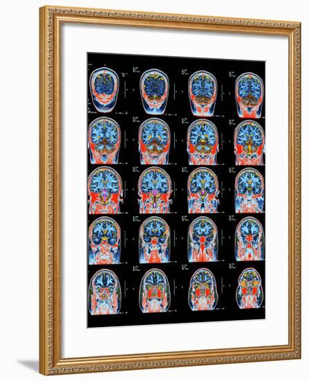 Healthy Brain, MRI Scans-Science Photo Library-Framed Photographic Print