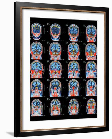 Healthy Brain, MRI Scans-Science Photo Library-Framed Photographic Print