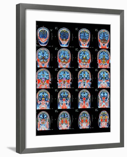 Healthy Brain, MRI Scans-Science Photo Library-Framed Photographic Print