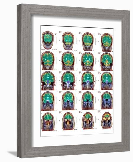 Healthy Brain, MRI Scans-Science Photo Library-Framed Photographic Print