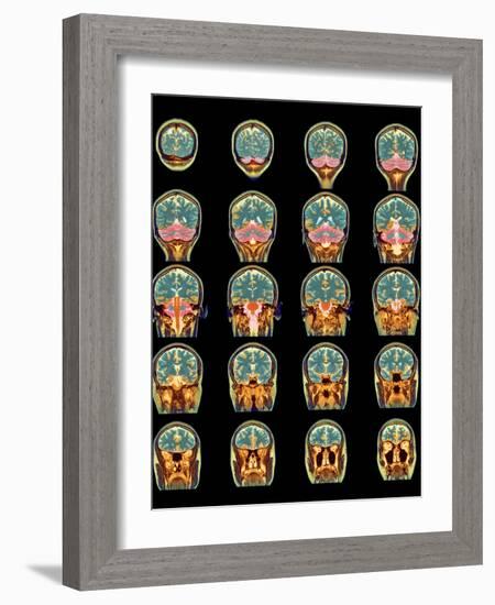 Healthy Brain, MRI Scans-Science Photo Library-Framed Photographic Print