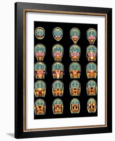 Healthy Brain, MRI Scans-Science Photo Library-Framed Photographic Print