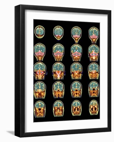 Healthy Brain, MRI Scans-Science Photo Library-Framed Photographic Print