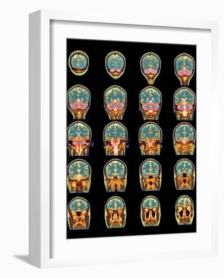 Healthy Brain, MRI Scans-Science Photo Library-Framed Photographic Print