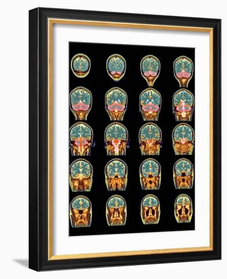 Healthy Brain, MRI Scans-Science Photo Library-Framed Photographic Print