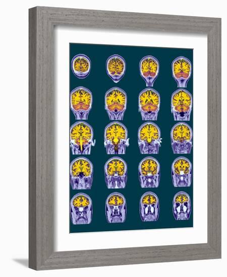 Healthy Brain, MRI Scans-Science Photo Library-Framed Photographic Print