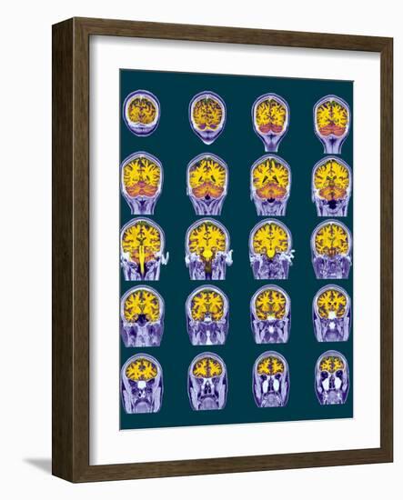 Healthy Brain, MRI Scans-Science Photo Library-Framed Photographic Print