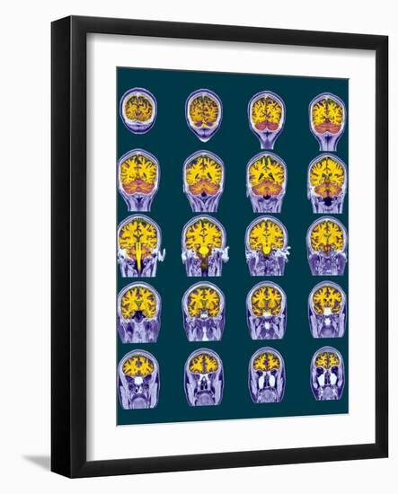 Healthy Brain, MRI Scans-Science Photo Library-Framed Photographic Print