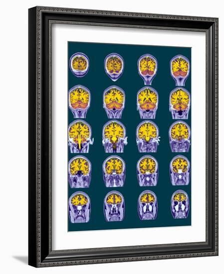 Healthy Brain, MRI Scans-Science Photo Library-Framed Photographic Print