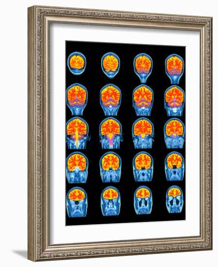 Healthy Brain, MRI Scans-Science Photo Library-Framed Photographic Print