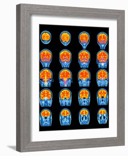 Healthy Brain, MRI Scans-Science Photo Library-Framed Photographic Print