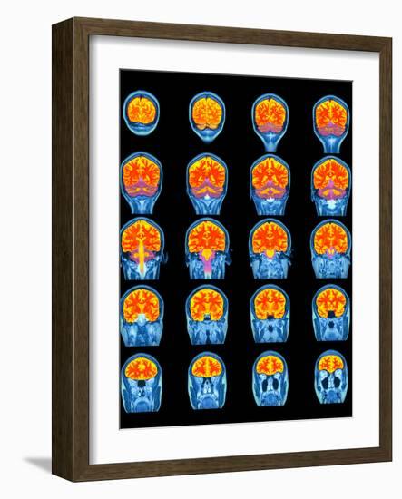 Healthy Brain, MRI Scans-Science Photo Library-Framed Photographic Print