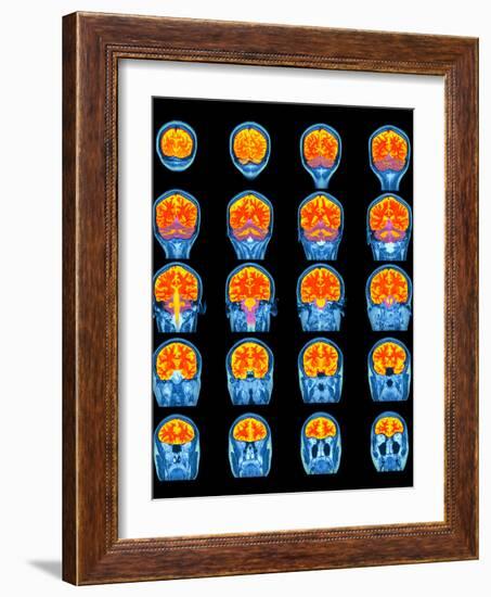 Healthy Brain, MRI Scans-Science Photo Library-Framed Photographic Print