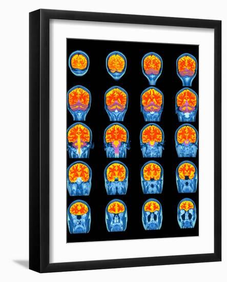 Healthy Brain, MRI Scans-Science Photo Library-Framed Photographic Print