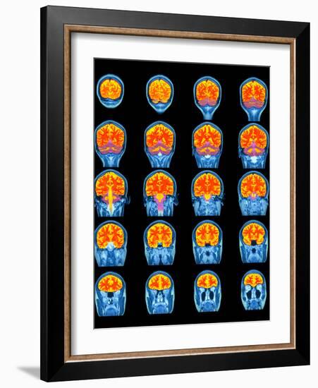 Healthy Brain, MRI Scans-Science Photo Library-Framed Photographic Print