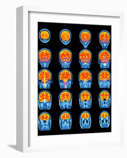 Healthy Brain, MRI Scans-Science Photo Library-Framed Photographic Print