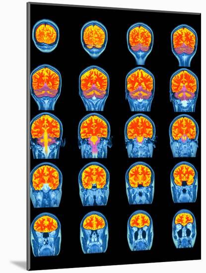 Healthy Brain, MRI Scans-Science Photo Library-Mounted Photographic Print