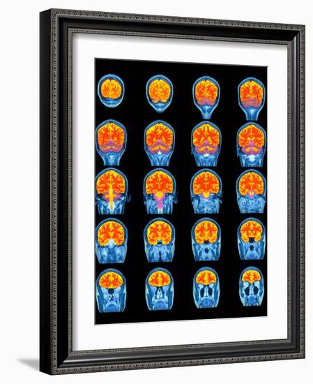 Healthy Brain, MRI Scans-Science Photo Library-Framed Photographic Print