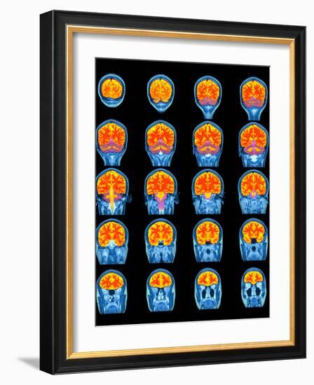 Healthy Brain, MRI Scans-Science Photo Library-Framed Photographic Print