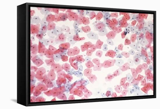 Healthy Cervical Smear-Science Photo Library-Framed Premier Image Canvas