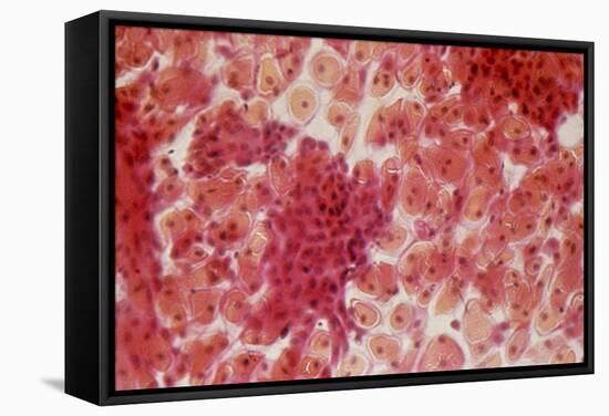 Healthy Cervical Smear-Science Photo Library-Framed Premier Image Canvas