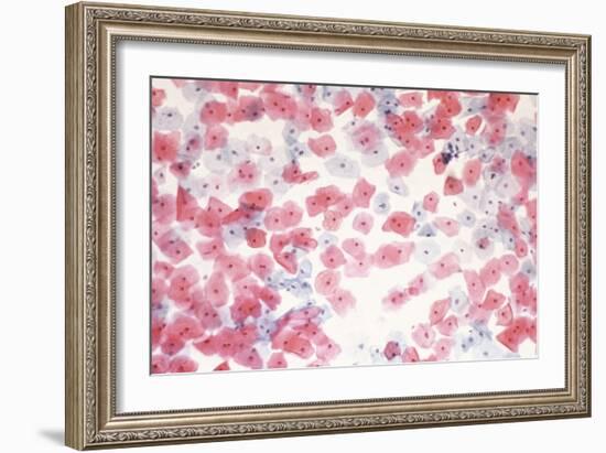 Healthy Cervical Smear-Science Photo Library-Framed Photographic Print