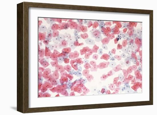 Healthy Cervical Smear-Science Photo Library-Framed Photographic Print
