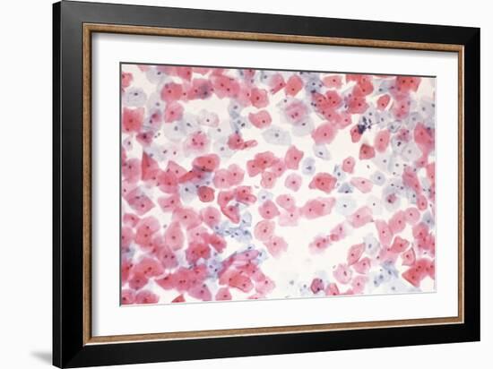 Healthy Cervical Smear-Science Photo Library-Framed Photographic Print