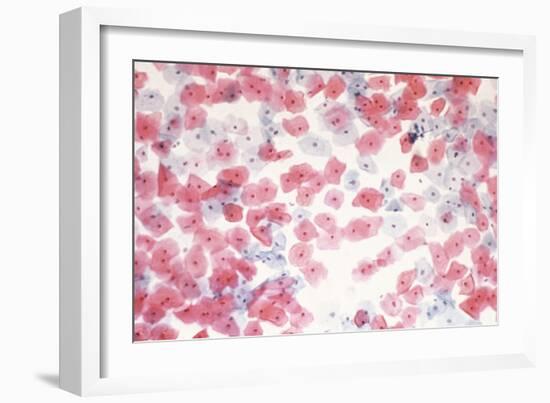 Healthy Cervical Smear-Science Photo Library-Framed Photographic Print