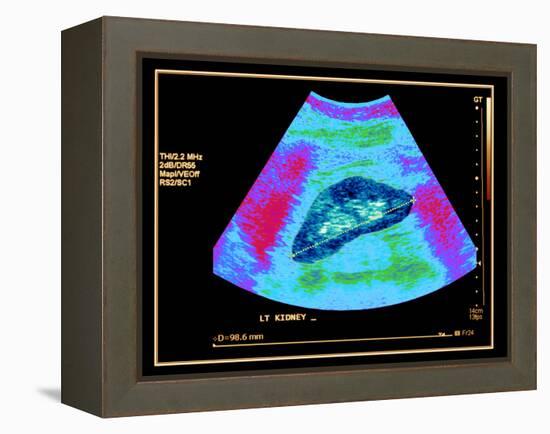 Healthy Kidney Measured, Ultrasound Scan-Science Photo Library-Framed Premier Image Canvas