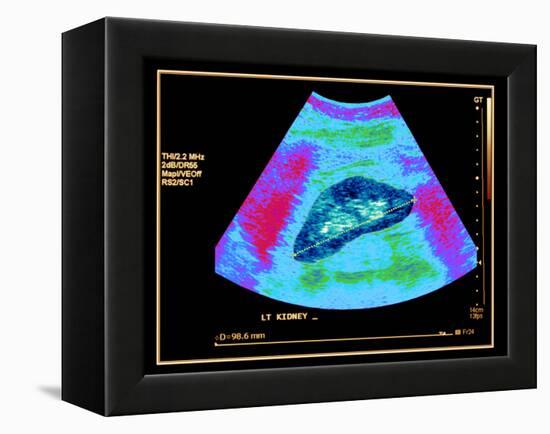 Healthy Kidney Measured, Ultrasound Scan-Science Photo Library-Framed Premier Image Canvas