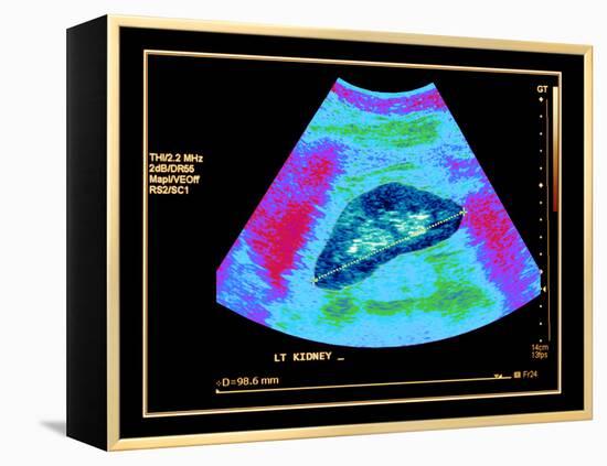 Healthy Kidney Measured, Ultrasound Scan-Science Photo Library-Framed Premier Image Canvas