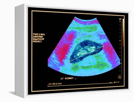 Healthy Kidney Measured, Ultrasound Scan-Science Photo Library-Framed Premier Image Canvas