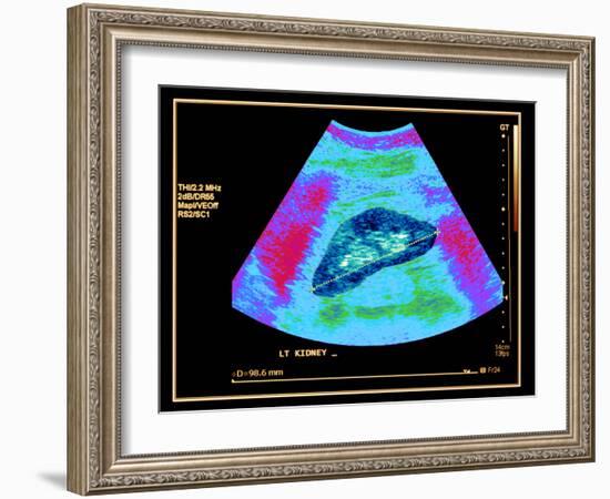 Healthy Kidney Measured, Ultrasound Scan-Science Photo Library-Framed Photographic Print